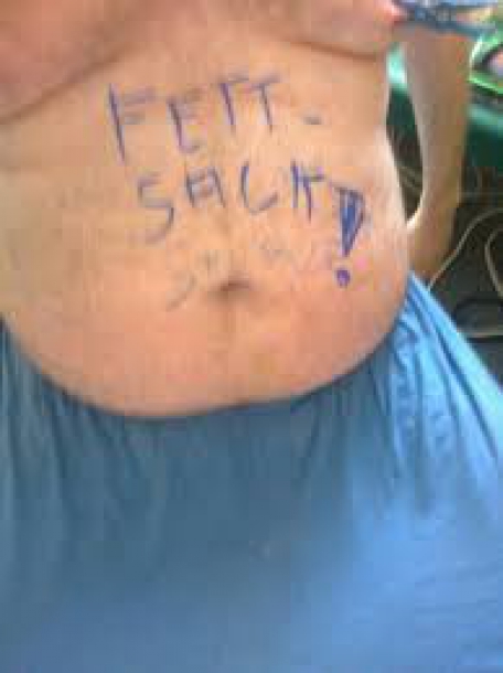fetter devoter sklave